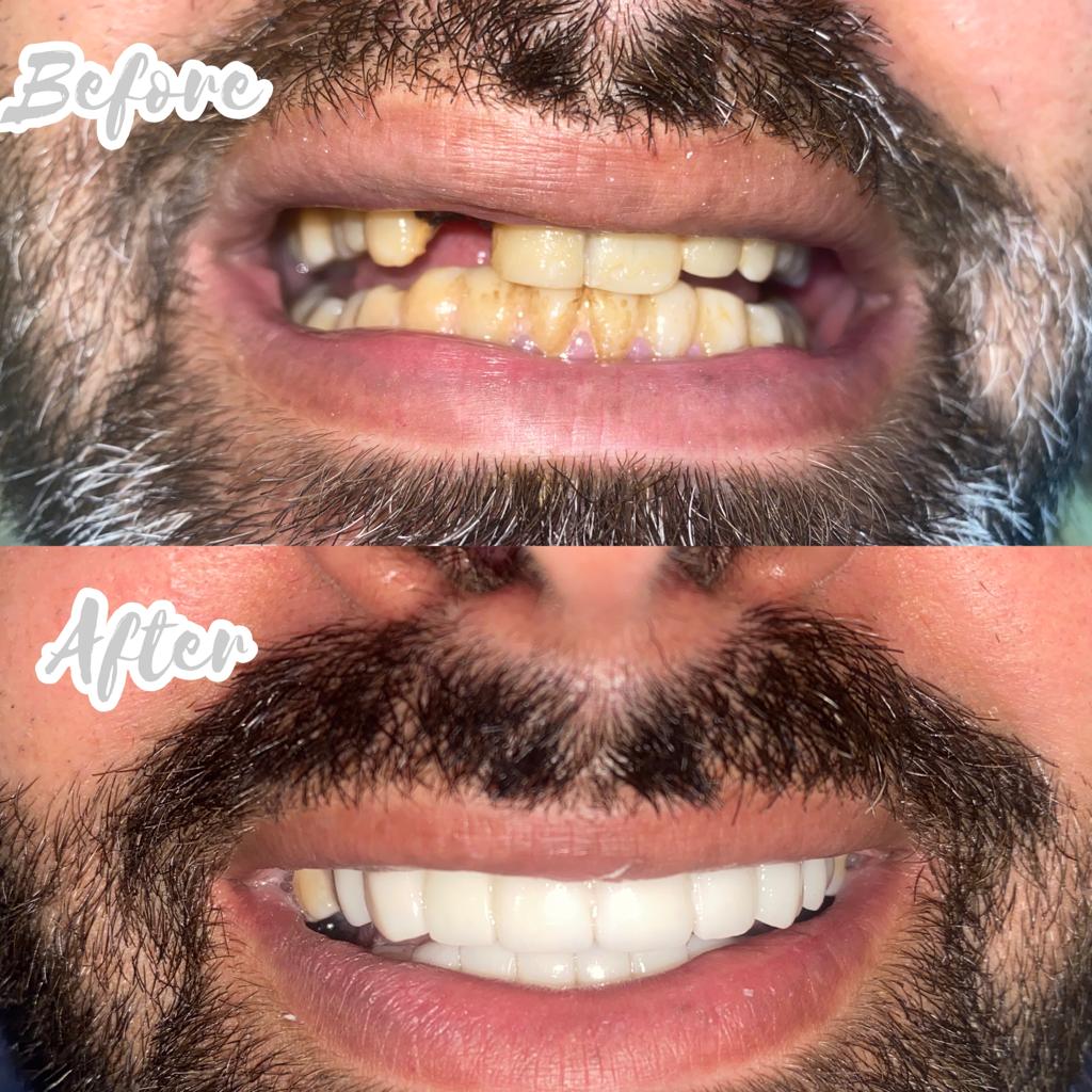 WhatsApp Image 2024-03-21 at 1.07.41 PM